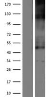 SLC19A2 / TC1 Protein (Over-Expression Lysate Myc-DDK (Flag))