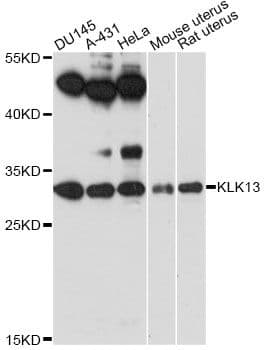 KLK13 / Kallikrein 13 Antibody
