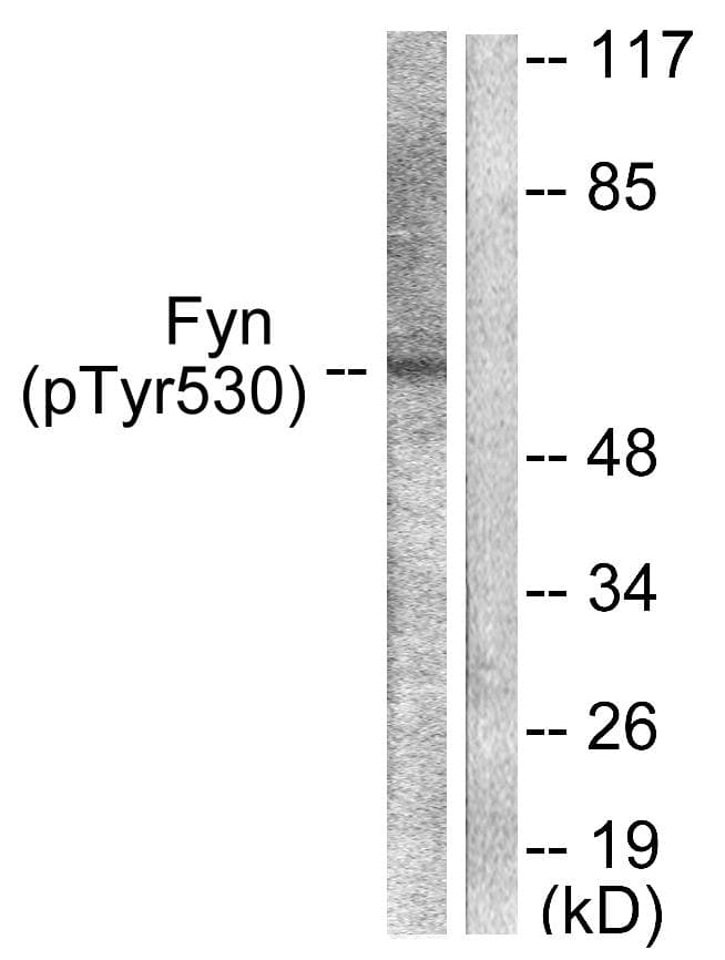 SYN / FYN Antibody (phospho-Tyr530)