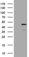 Monoclonal Mouse anti-Human ABCB1 / MDR1 / P Glycoprotein Antibody (clone OTI2G7, WB)
