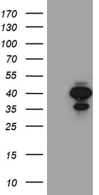 M-PST / STM Antibody (clone OTI1C6)