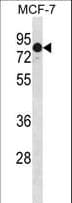 Polyclonal Rabbit anti-Human GATAD2A Antibody (aa1-30, WB)