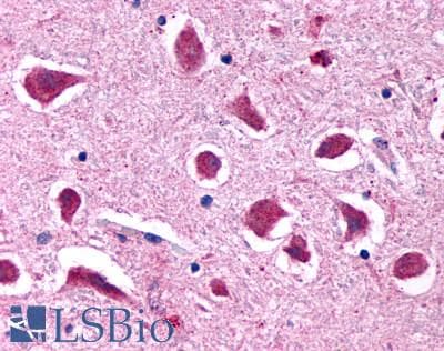 PathPlus™ HTR2B / 5-HT2B Receptor Antibody (Extracellular Domain)