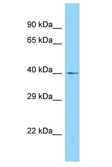 LASS4 Antibody (aa281-330)