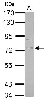 RP105 / CD180 Antibody (Internal)