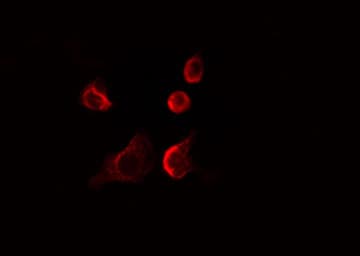 Polyclonal Rabbit anti-Human EIF4E3 Antibody (IF, WB)