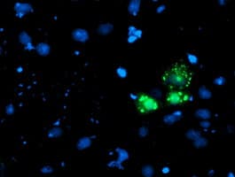 AP50 / AP2M1 Antibody (aa97-383, clone OTI1E9)
