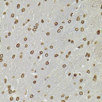 CDX2 Antibody
