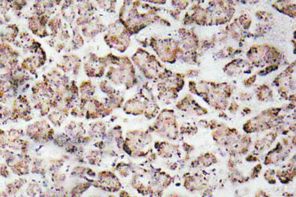 IGF1 Antibody (aa100-149)