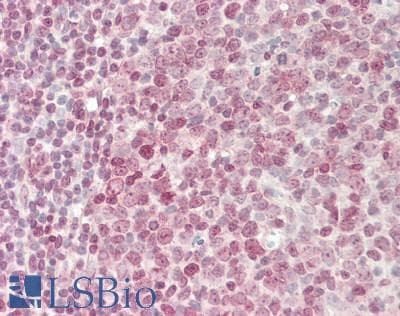 IHC-plus™ ETV6 / TEL Antibody (aa223-272)