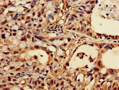 Polyclonal Rabbit anti-Human CASK Antibody