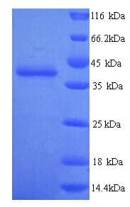 Human TLN2 / Talin 2 Protein (Recombinant His)