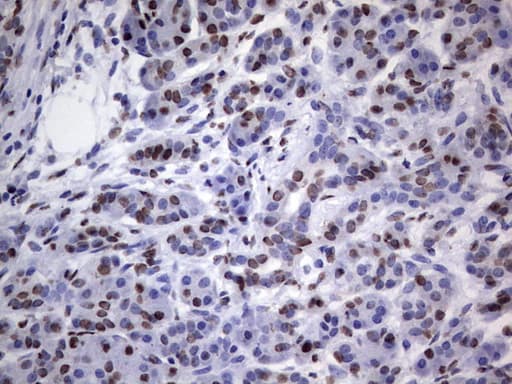 HNRNPL / hnRNP L Antibody (aa270-502, clone OTI2E4)