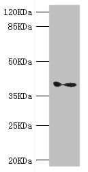 GDAP1 Antibody