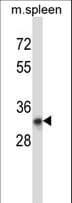 TATDN1 Antibody (aa115-143)