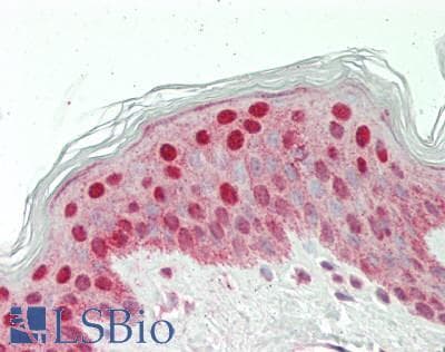 IHC-plus™ Polyclonal Rabbit anti-Human CACYBP Antibody (aa200-228, IHC, WB)