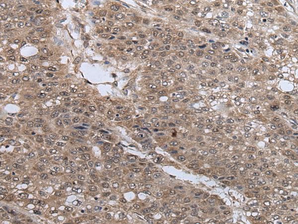 UFD2A / UBE4B Antibody