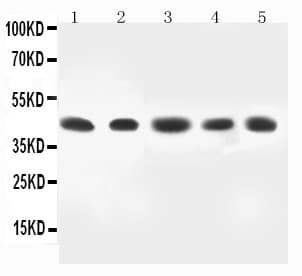 MAP2K4 / MKK4 Antibody (aa360-378)