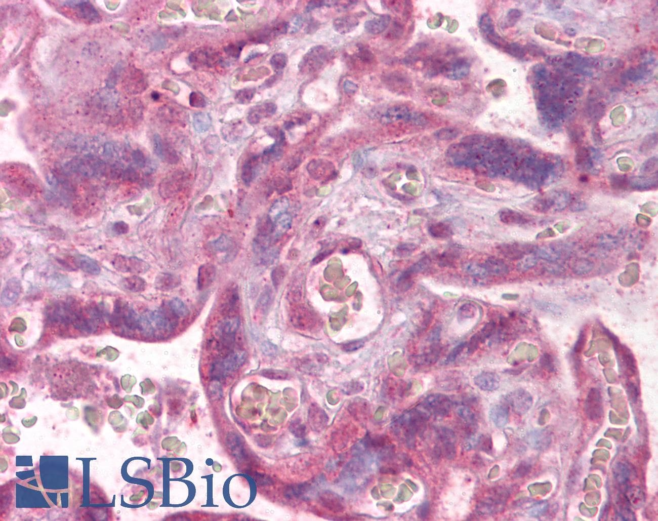 IHC-plus™ Polyclonal Rabbit anti-Human PLK1 / PLK-1 Antibody (aa100-200, IHC, WB)