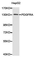 PDGFRA / PDGFR Alpha Antibody