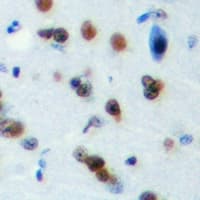 Polyclonal Rabbit anti-Human PLEKHG4 Antibody (Internal, IHC, WB)