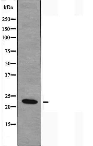 NDUFB9 Antibody