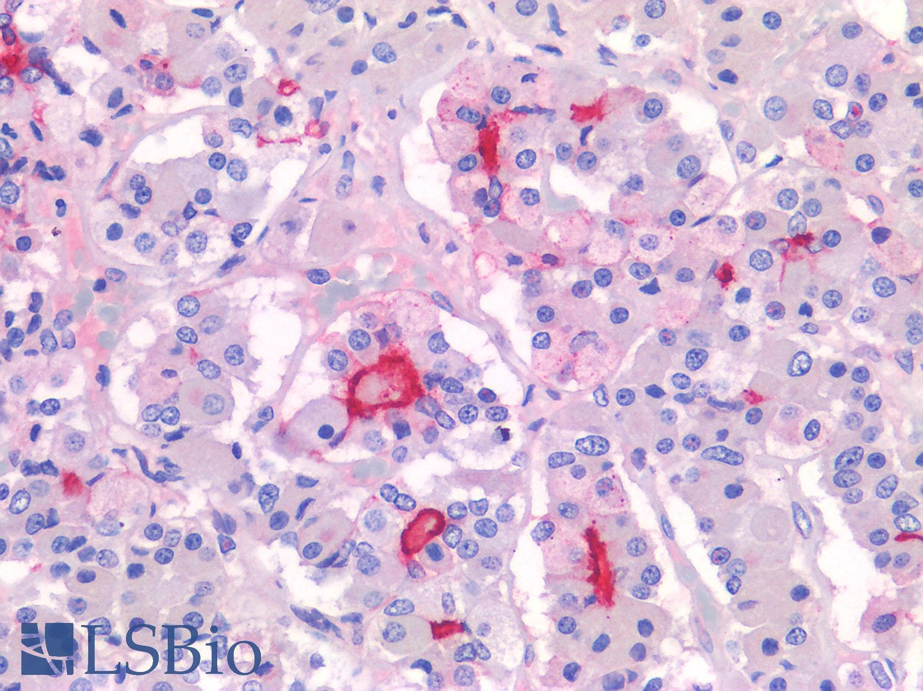 IHC-plus™ SLC18A3 / VACHT Antibody