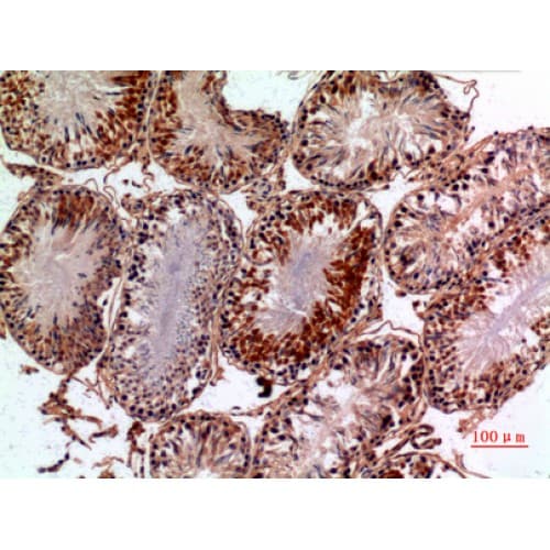 Polyclonal Rabbit anti-Human PNPLA6 / NTE Antibody (1031-1080 aa, Internal, IHC, WB)