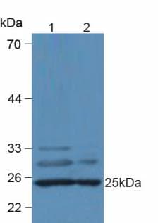 Complement C1QA Antibody (aa23-245, Biotin)