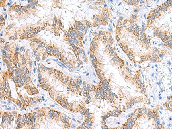 HRSP12 / UK114 Antibody
