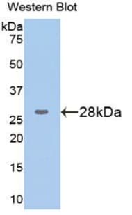 GPI Antibody (aa263-475)