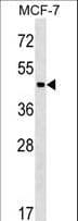 Polyclonal Rabbit anti-Human ZBTB12 / G10 Antibody (aa413-440, WB)