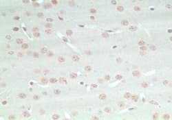 ARHGAP20 Antibody (aa570-620)