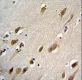 Polyclonal Rabbit anti-Human HARBI1 Antibody (aa4-33, IHC, WB)