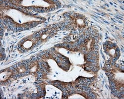PRKAR2A Antibody (clone OTI4A3)