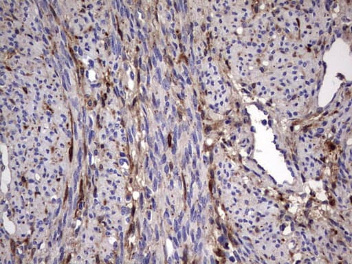 LGALS3 / Galectin 3 Antibody (clone OTI1C7)