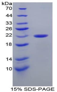 Human PARK7 / DJ-1 Protein (Recombinant His)