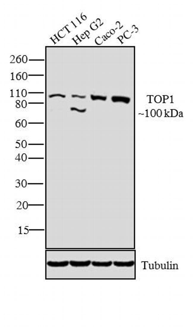 TOP1 / Topoisomerase I Antibody (N-Terminus, clone 24.5)