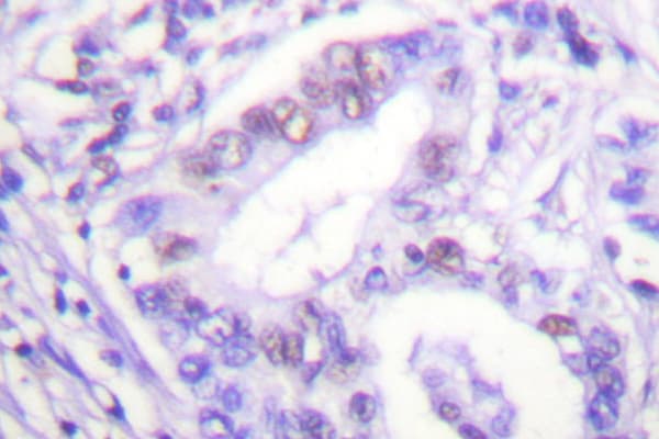Polyclonal Rabbit anti-Human PIAS4 / PIASY Antibody (Asp488, IHC, WB)