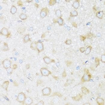 Polyclonal Rabbit anti-Human KIAA1811 / BRSK1 Antibody (IHC)