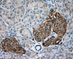 TUBA8 / Tubulin Alpha 8 Antibody (clone OTI2G6, Carrier-free)