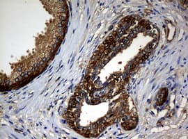 NME1 / NM23 Antibody (clone OTI7F6)