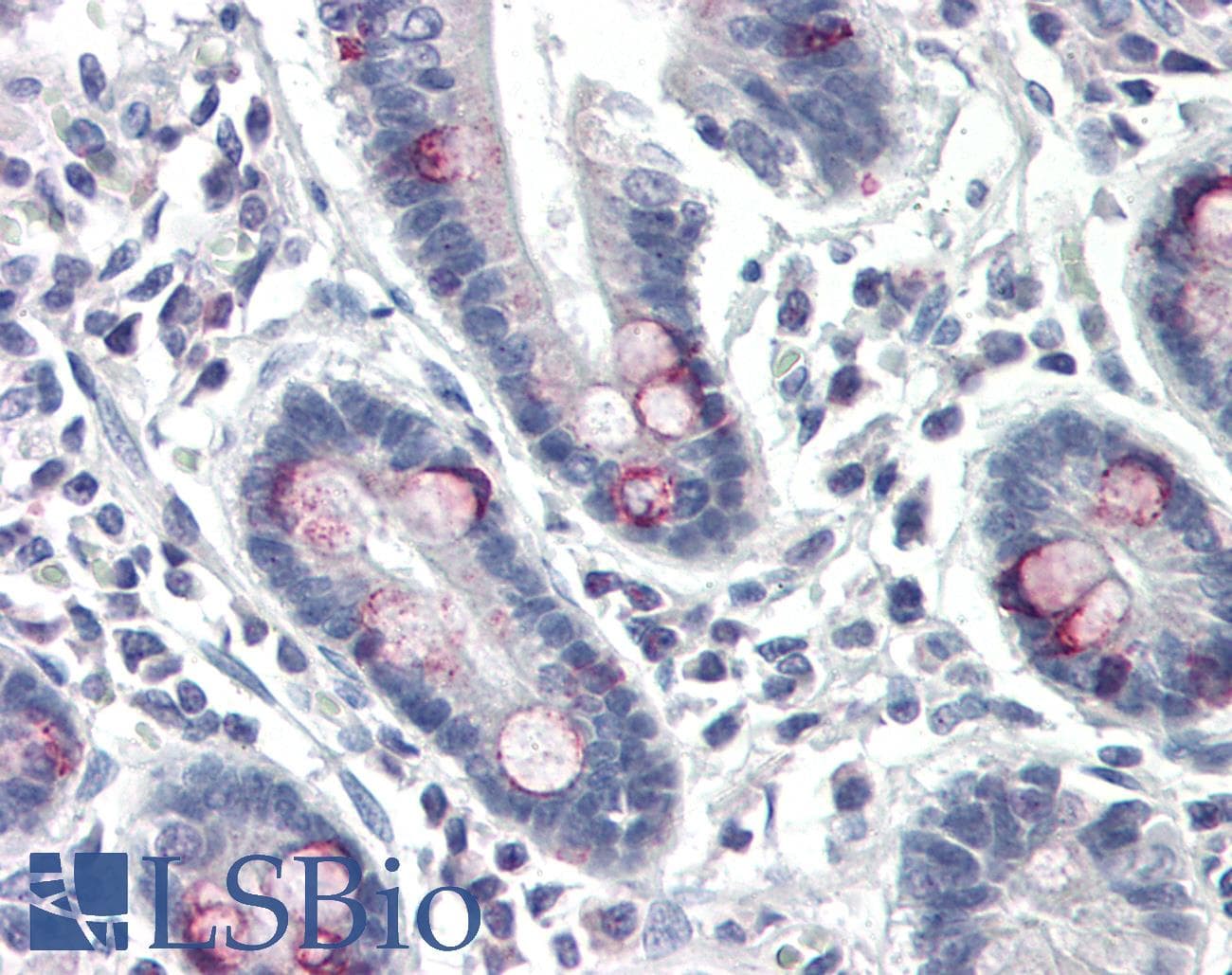 Polyclonal Rabbit anti-Human NCR2 / NKP44 Antibody (IHC, WB)