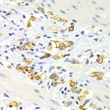 DRD4 / Dopamine Receptor D4 Antibody