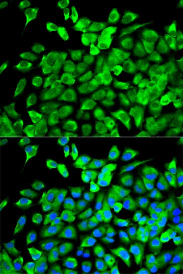 Polyclonal Rabbit anti-Human EIF4A1 Antibody (IF, WB)