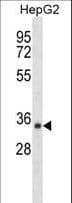 SDR39U1 Antibody (aa77-103)