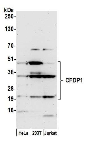 Polyclonal Rabbit anti-Human CFDP1 Antibody (aa249-299, WB)