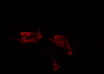 SYN1 / Synapsin 1 Antibody (phospho-Ser9)