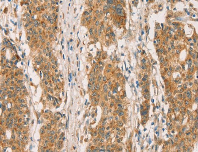Polyclonal Rabbit anti-Human RBBP8 / CTIP Antibody (IHC)