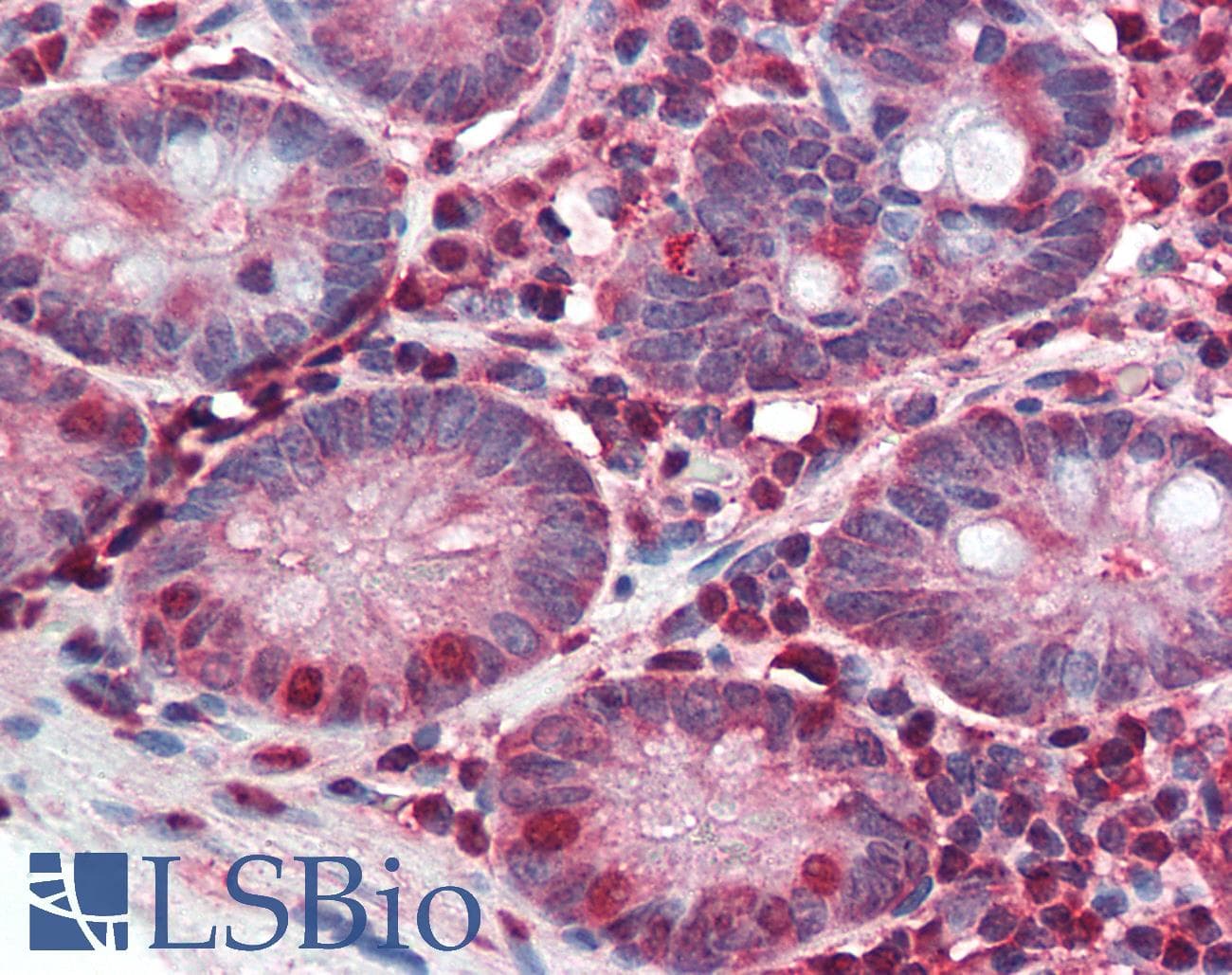 IHC-plus™ Polyclonal Rabbit anti-Human PIGR Antibody (Cytoplasmic Domain, IHC)